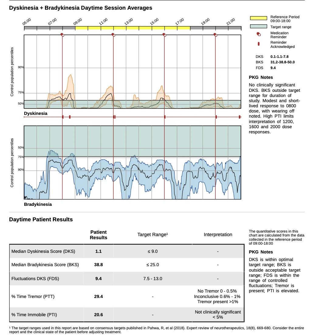 A PKG report using demonstration data: daytime dyskinesia and bradykinesia session averages charted over the day, with a table of daytime patient results beside clinical notes.